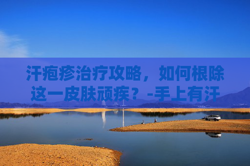 汗疱疹治疗攻略，如何根除这一皮肤顽疾？-手上有汗疱疹怎么治疗除根