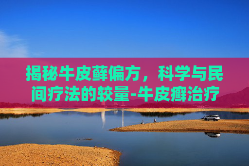 揭秘牛皮藓偏方,科学与民间疗法的较量-牛皮癣治疗偏方 揭秘牛皮藓偏方,科学与民间疗法的较量-牛皮癣治疗偏方