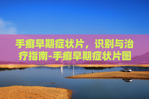 手癣早期症状片，识别与治疗指南-手癣早期症状片图片
